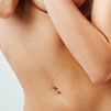 Liposuction Gallery